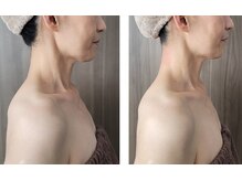 人気No.1コルギの施術前後写真　全てオールハンド仕上げ