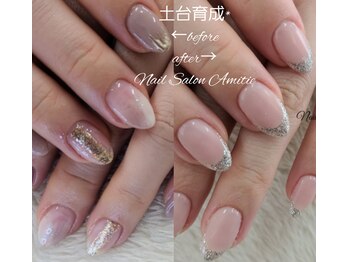 改善から変化して美爪生活へ