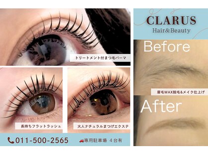 クラルス(CLARUS)の写真