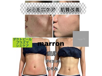 マロン(marron)の写真