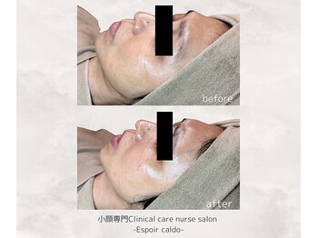 エスポワールカルド(Espoir caldo)/