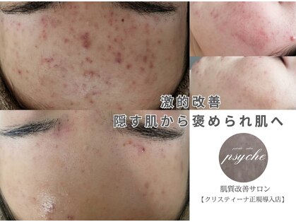 プシュケ(Psyche)の写真