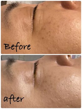 サロンドベルファム(Salon de Bellefemme)/フェイシャルトリートメント