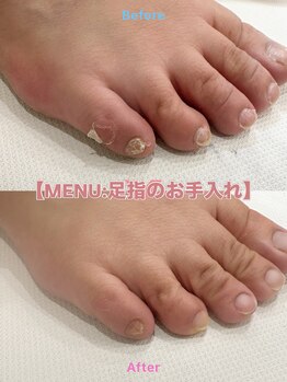 ポップ(POP!!)の写真/定期的なケアで健やかな爪と肌の維持をサポート致します。何も塗らないナチュラルネイルも好きになれる！