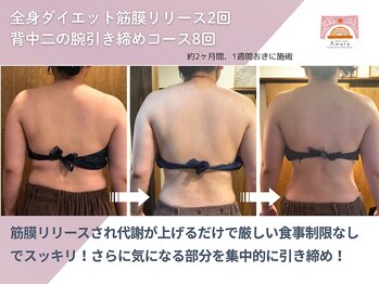 アマテ(Amate)/背中のはみ肉、振りそで撃退★