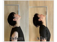 整体ラルース 中目黒(LALUZ)/40代 女性 ストレートネック改善