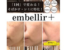 アンベリールプラス(embellir+)