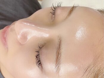 グレイス(Grace)/施術イメージ