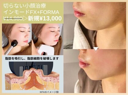 ルディラ医療提携エステ 恵比寿店 毛穴/小顔/ニキビ・シミ・美白・シワ・たるみケアの写真