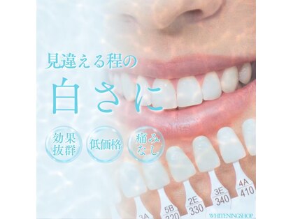 ホワイトニングショップ 鹿児島店の写真
