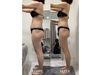 ナルシス/【痩身】約10ヶ月の変化★