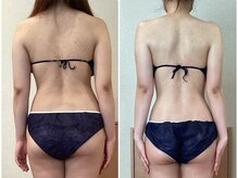 サロンドルフレ(salon de Reflet)の雰囲気(『昔と比べてなんか違う』と感じている方へ体型を整える専門ケア)