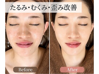 シャラ(shara)の写真