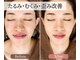 シャラ(shara)の写真