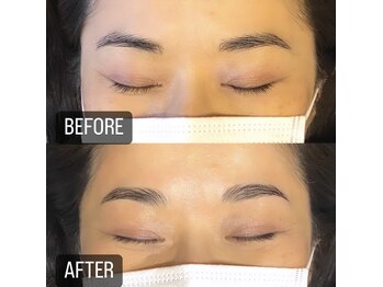 エム(emu)/眉(ハリウッドブロウリフト)