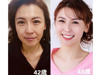 ランスソア(L'ins soi)/