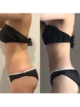 トータルビューティーサロンリア(Li'a)/スタイルアップ/理想のボディへ