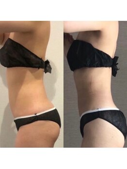 トータルビューティーサロンリア(Li'a)/スタイルアップ/理想のボディへ