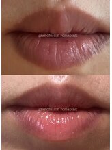 テセラ(Tethere)/ローマピンク