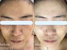 アルページュ(Arpege)/本来のお肌の美しさ引き出します