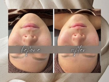 ゴールデンケア(goldencare)/【左右差・バランス】がお悩み!