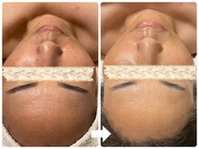 サロン ド ジョワ(salon de joie)/美白！トーンアップ効果