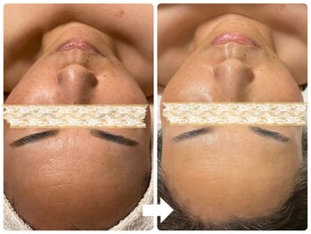 サロン ド ジョワ(salon de joie)/美白！トーンアップ効果