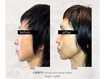 エスポワールカルド(Espoir caldo)/