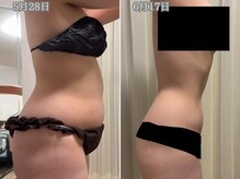 レイル(REIR)の雰囲気（運動なしでサプリのみで20日後の変化です★これは私です（笑））