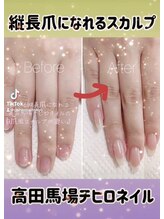 チヒロネイル/縦長ネイルベットスカルプ