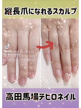 チヒロネイル/縦長ネイルベットスカルプ