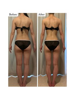 ベル 恵比寿(Belle)/エンダモロジーアライアンス