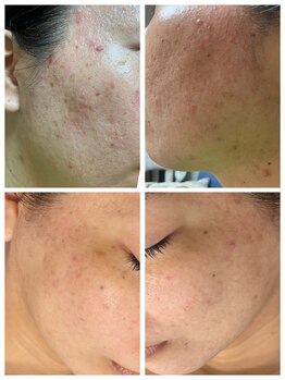 エリー(ERIE)/長年の悩みも解決へ