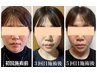 【とにかく小さく】３６０度どこから見られてもキュッと引き締まった小顔に！