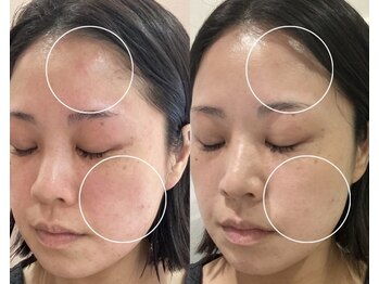 ミュー 岡崎店(mieux)/◇赤み・乾燥対策にも◎