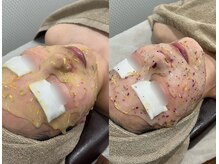 TD 鵜沼店/ハイドロジェリーマスク