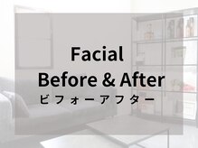 リライブ 亀有店(Re:Lives)/小顔・美肌のBefore&After♪