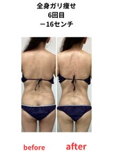 ステラ(Stella)/6回で16cmの変化