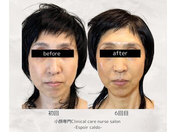 エスポワールカルド(Espoir caldo)/