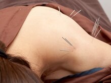 首・肩・腰の痛みに対してお悩みの方。