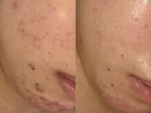 アン(An)の雰囲気（1人1人のお悩みに寄り添い根本改善に向けてしっかりサポート）