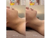 ピエルポゼ(Piereposer)の雰囲気（フェイシャル小顔）