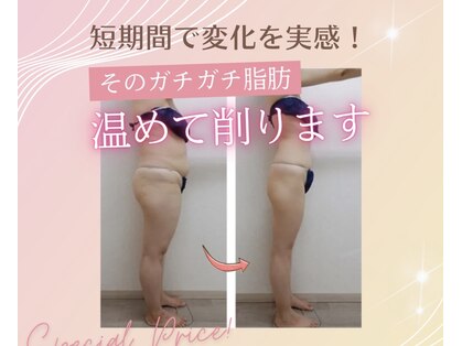 グレースフルの写真