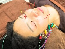 カンナ 福岡(Canna)の雰囲気（美容鍼で小顔×たるみ×むくみ×肩こり同時ケア！スッキリ実感）