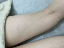 ナノハナ/鹿沼市の全身脱毛美容室ナノハナ