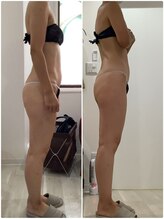 プラチナアース つくば店(Platinum earth)/痩身ビフォーアフター