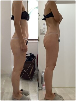 プラチナアース つくば店(Platinum earth)/痩身ビフォーアフター