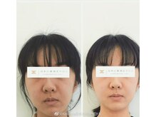 美骨矯正サロン メディカルカイロテルボ 高田馬場店/脳圧調整&小顔矯正