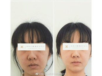 美骨矯正サロン メディカルカイロテルボ 高田馬場店/脳圧調整&小顔矯正