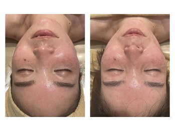 ブーケ(Bouquet)/左右非対称◆歪みケア